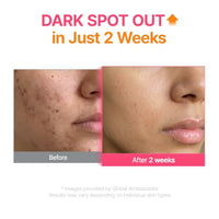 Thumbnail for Image 4 of PURITO TXA 6% Niacinamide 10% Serum for Sensitive Skin, 1.01 fl.oz