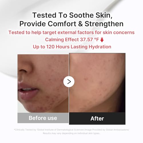 Image 4 of medicube Comforting Serum & Cream Duo Ideal for After Spot Care