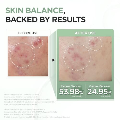 Image 5 of SKIN1004 Azelaic Acid 10% Ampoule, Korean Facial Centella Serum,1.01 fl.oz