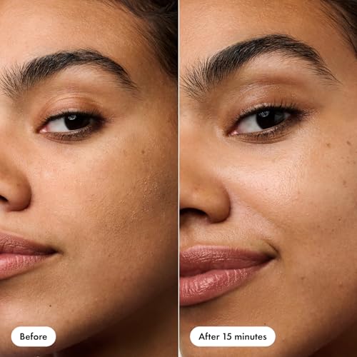 Image 4 of HERO COSMETICS Rescue Patch Moisturizing Post-Blemish Cream Patch, 6 Ct