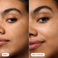Thumbnail for Image 4 of HERO COSMETICS Rescue Patch Moisturizing Post-Blemish Cream Patch, 6 Ct