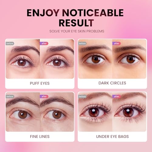 Image 5 of AILEORY Under Eye Patches (36 Pairs)