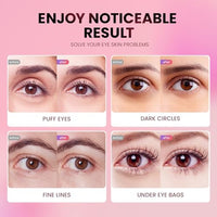 Thumbnail for Image 5 of AILEORY Under Eye Patches (36 Pairs)