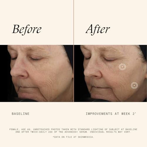 Image 4 of SkinMedica TNS Advanced+ Face Serum (1 oz)
