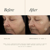 Thumbnail for Image 4 of SkinMedica TNS Advanced+ Face Serum (1 oz)