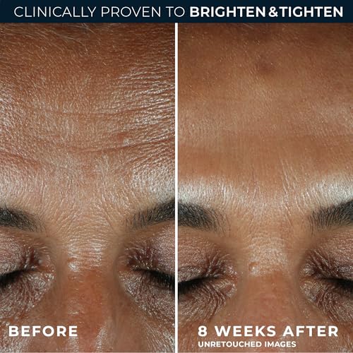 Image 5 of RoC Vitamin C Serum for Face Multi Correxion Revive + Glow, 10% Active, 1oz