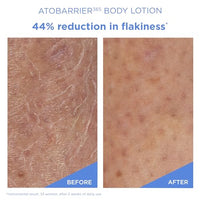 Thumbnail for Image 3 of AESTURA ATOBARRIER365 Korean Body Lotion with Ceramides & Glycerin, 400 ML