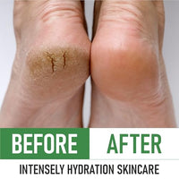 Thumbnail for Image 9 of PurOrganica Urea Cream 40% for Dry Cracked Heels and Calluses