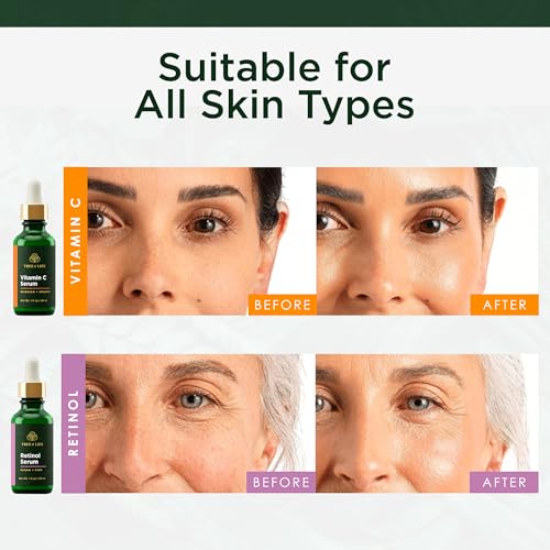 Image 3 of Tree of Life Face Serum Skin Care Set, Vitamin C & Retinol Serum for Face