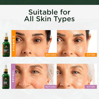 Thumbnail for Image 3 of Tree of Life Face Serum Skin Care Set, Vitamin C & Retinol Serum for Face
