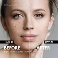 Thumbnail for Image 5 of EnaSkin Dark Spot Corrector Set, Serum & Kojic Acid Soap for Body & Face