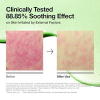 Thumbnail for Image 6 of ANUA Azelaic Acid 10 Hyaluronic Acid Soothing Toner Pads, 90 Pads