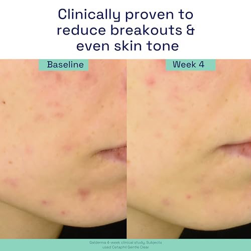 Image 6 of Cetaphil Gentle Clear Acne Serum Salicylic Acid Treatment, 1oz