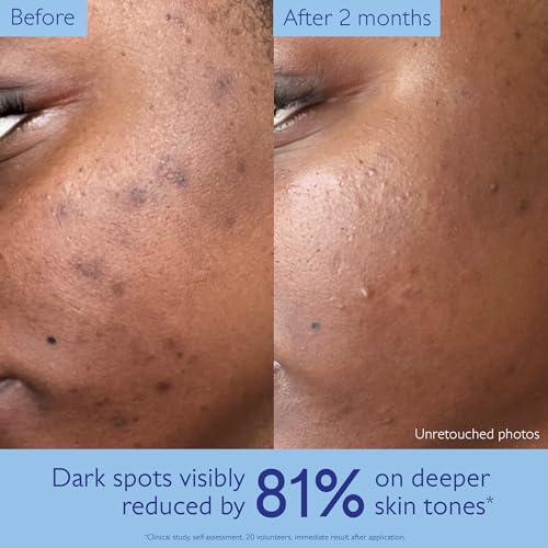 Image 4 of Caudalie Vinoperfect Brightening Dark Spot Serum Vitamin C Alternative