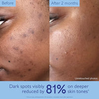 Thumbnail for Image 4 of Caudalie Vinoperfect Brightening Dark Spot Serum Vitamin C Alternative