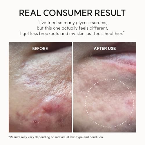Image 5 of ARENCIA Erasor Shot Glycolic Acid Booster Serum and Soothing Cream