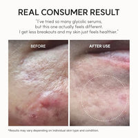 Thumbnail for Image 5 of ARENCIA Erasor Shot Glycolic Acid Booster Serum and Soothing Cream