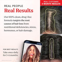 Thumbnail for Image 5 of HAIRtamin Vegan Gummy Stars Hair Vitamins 3-Pack