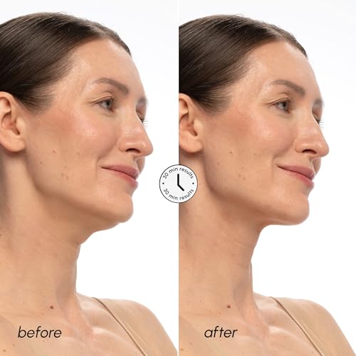 Image 3 of MAREE PDRN Salmon DNA Chin Lifting Mask 10 Ct