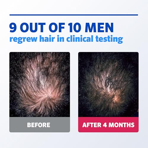Image 6 of Rogaine Men's 5% Minoxidil Foam, 1-Month Supply, 2.11 oz