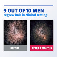 Thumbnail for Image 6 of Rogaine Men's 5% Minoxidil Foam, 1-Month Supply, 2.11 oz