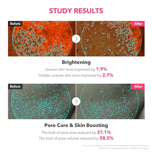 Image 5 of APRILSKIN TXA Niacinamide Toning Shot Serum