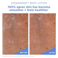 Thumbnail for Image 4 of AESTURA ATOBARRIER365 Korean Body Lotion with Ceramides & Glycerin, 400 ML