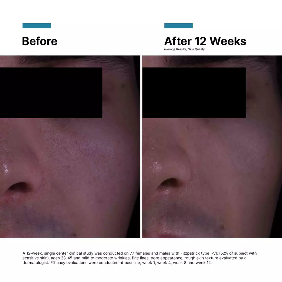 Skinceuticals P-TIOX Anti-Wrinkle Cream 48ml