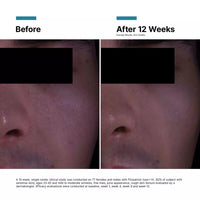 Thumbnail for Skinceuticals P-TIOX Anti-Wrinkle Cream 48ml
