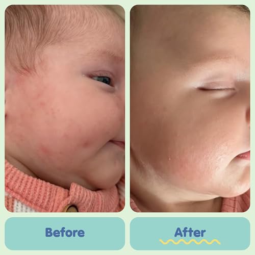 Image 10 of TUBBY TODD All Over Ointment Baby Eczema Cream for Sensitive Skin