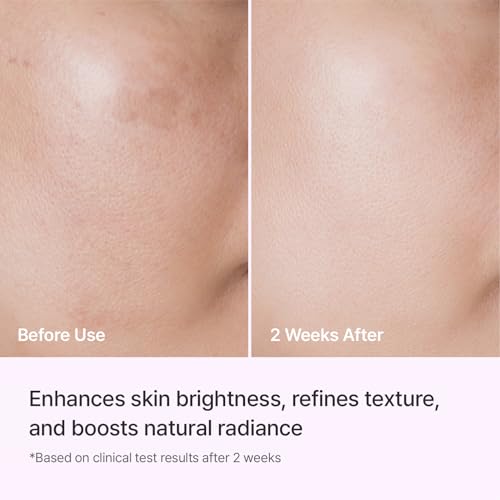 Image 5 of REJURAN Triple Radiance Ampoule c-PDRN?Brightening Face Serum, 1.01 fl oz