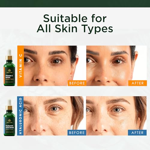 Image 3 of Tree of Life Face Serum Skin Care Set of 2