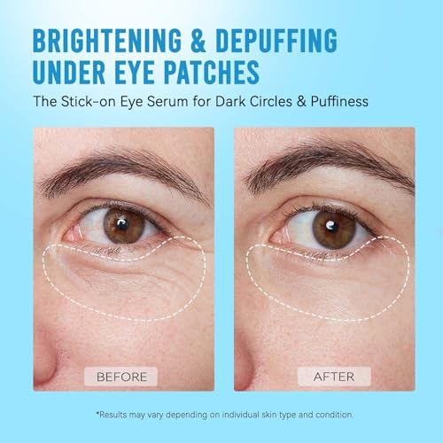 Image 6 of AILEORY Under Eye Patches for Dark Circles and Puffiness, 24 Pairs