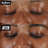 Thumbnail for Image 6 of Kiehl's Clearly Corrective Dark Spot Solution Brightening Serum