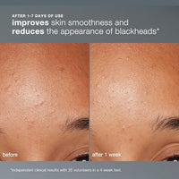 Thumbnail for Image 6 of Dermalogica Daily Microfoliant