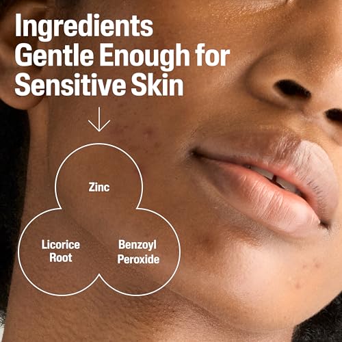 Image 5 of Cetaphil Gentle Clear BPO Acne Face Wash, Soothing, Sensitive Skin, 4.2oz