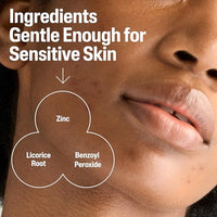 Thumbnail for Image 5 of Cetaphil Gentle Clear Complexion-Clearing BPO Acne Cleanser 4.2oz Pack of 12