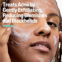 Thumbnail for Image 3 of Cetaphil Gentle Clear Acne Foaming Face Wash, 2% Salicylic Acid, 8oz