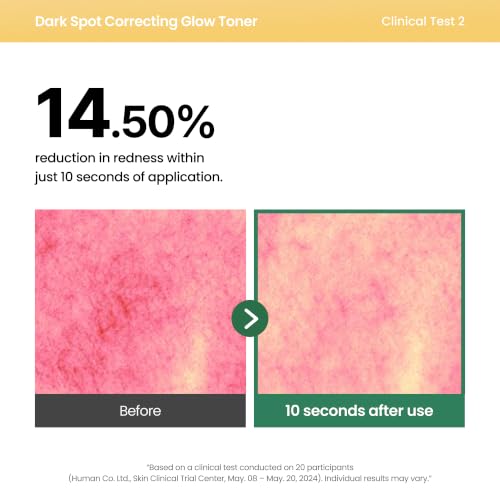 Image 5 of AXIS-Y Dark Spot Correcting Glow Toner with 5% Niacinamide, 4.23 fl. oz.