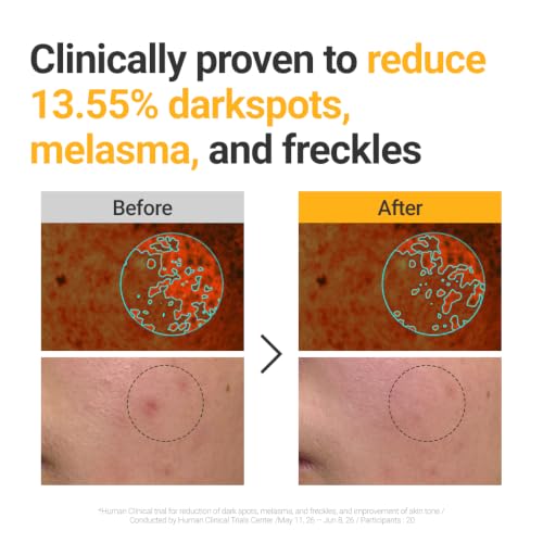Image 5 of ROVECTIN Vita Dark Spot Correcting Serum 1.01 Fl Oz (30 ml)