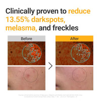 Thumbnail for Image 5 of ROVECTIN Vita Dark Spot Correcting Serum 1.01 Fl Oz (30 ml)