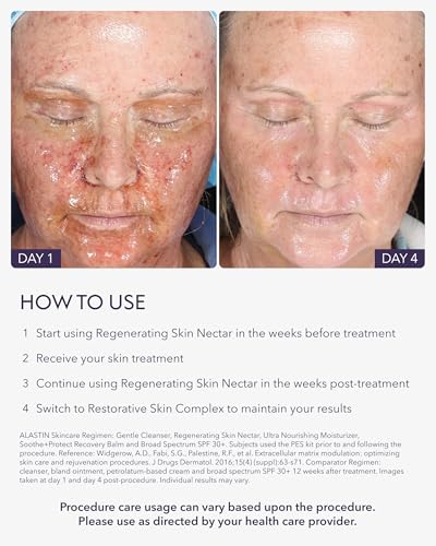 Image 5 of ALASTIN Skincare Regenerating Skin Nectar Face Moisturizer (1 oz)
